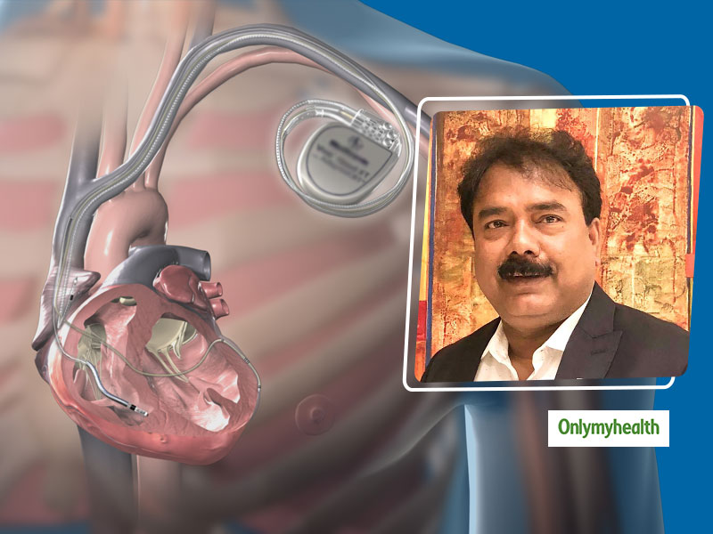 Implantable Cardioverter Defibrillator Therapy To Reduce Mortality Among Sudden Cardiac Arrest Patients